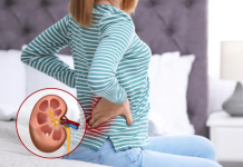 Shkencëtarët krijojnë mikrobe të zorrëve të modifikuara gjenetikisht që zbërthejnë gurët në veshka