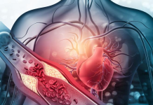 Të njohim kolesterolin për të mbajtur zemrën të shëndetshme