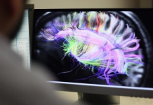 OBSH: Shumica e vendeve nuk kanë politika për të trajtuar çrregullimet neurologjike