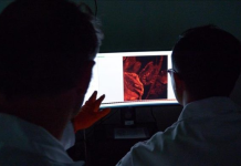 Identifikohet “çelësi” imunitar për të ndihmuar trupin të luftojë kancerin