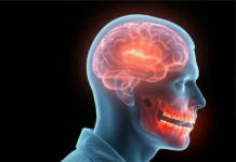 Higjiena e dobët dentare mund të tkurrë qendrën e kujtesës së trurit