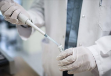 OBSH: 1.3 milion njerëz u prekën nga AIDS në 2024-ën