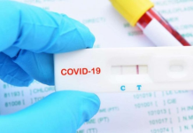 9% raste pozitive me COVID 19 nga 20 mijë testime të shpejta gjatë 2025-ës