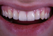 Jo zemra, jo truri, dhëmbët zbulojnë sekretin e jetëgjatësisë