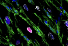 Zemra mund të rigjenerohet pjesërisht pas një infarkti