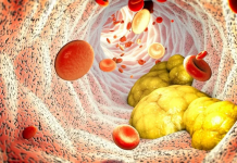 Kolesteroli i lartë shoqërohet me jetëgjatësi më të madhe