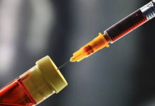 Testi i ri i gjakut parashikon fillimin e simptomave të Alzheimerit disa vite përpara