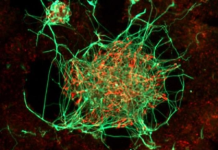 Japonia jep dritën jeshile, qeliza staminale kundër sëmundjes së Parkinsonit