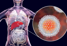 Italia rol lider në Evropë për zhdukjen e hepatitit C