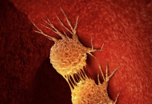 “Science”: Mungesa e vitaminës B7 mund të frenojë zhvillimin e tumoreve