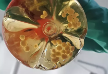 Organoidet e trurit përdoren për ndërtimin e biokompjuterëve